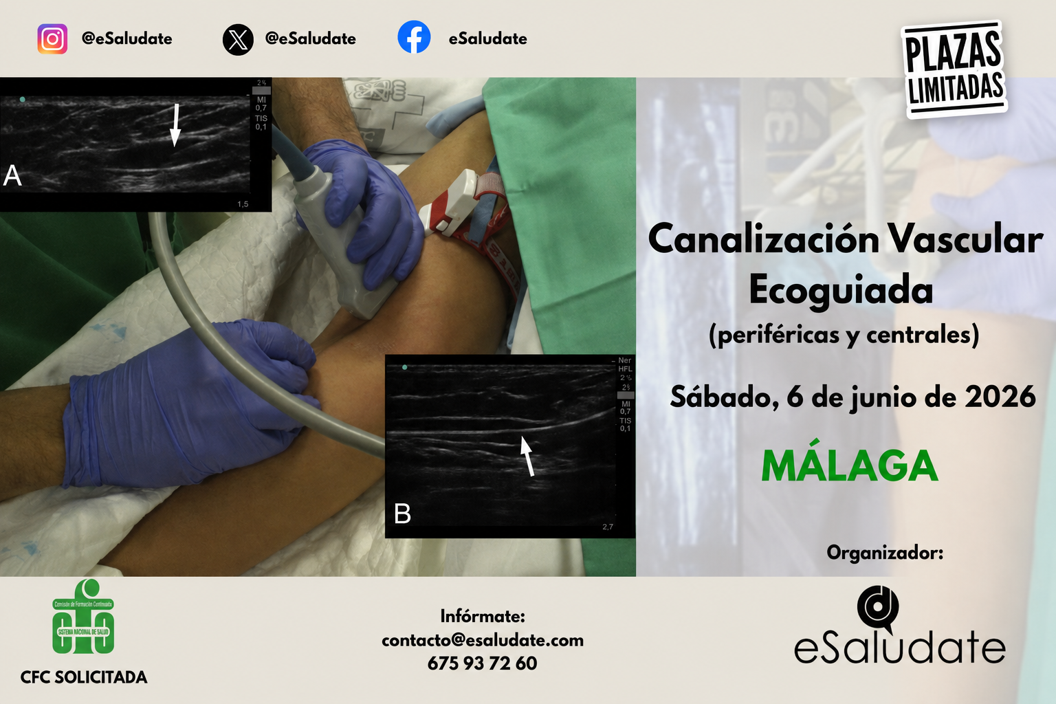 Málaga acogerá un curso presencial de Canalización Vascular Ecoguiada para profesionales sanitarios Resumen