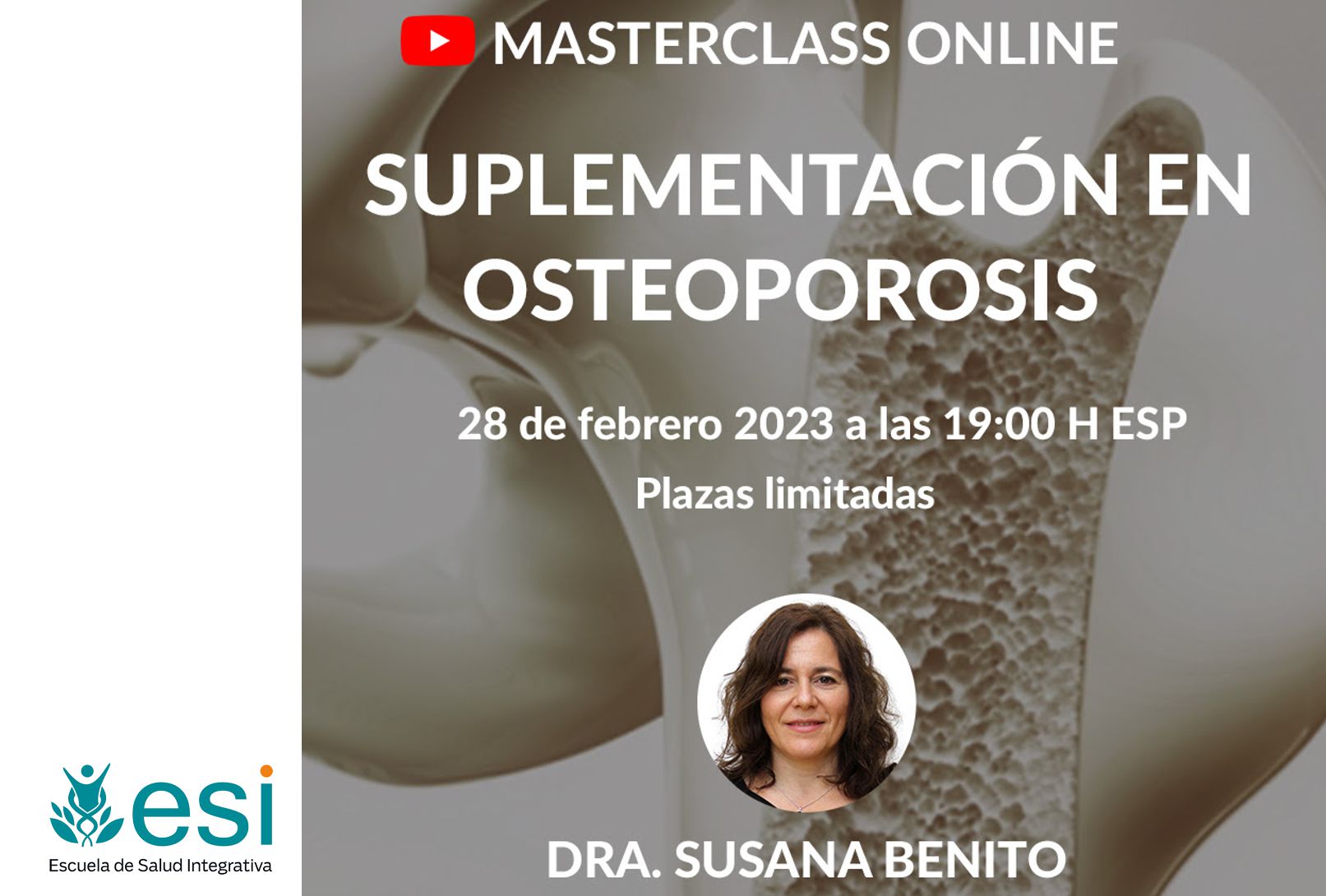 MASTERCLASS ONLINE: SUPLEMENTACION EN OSTEOPOROSIS